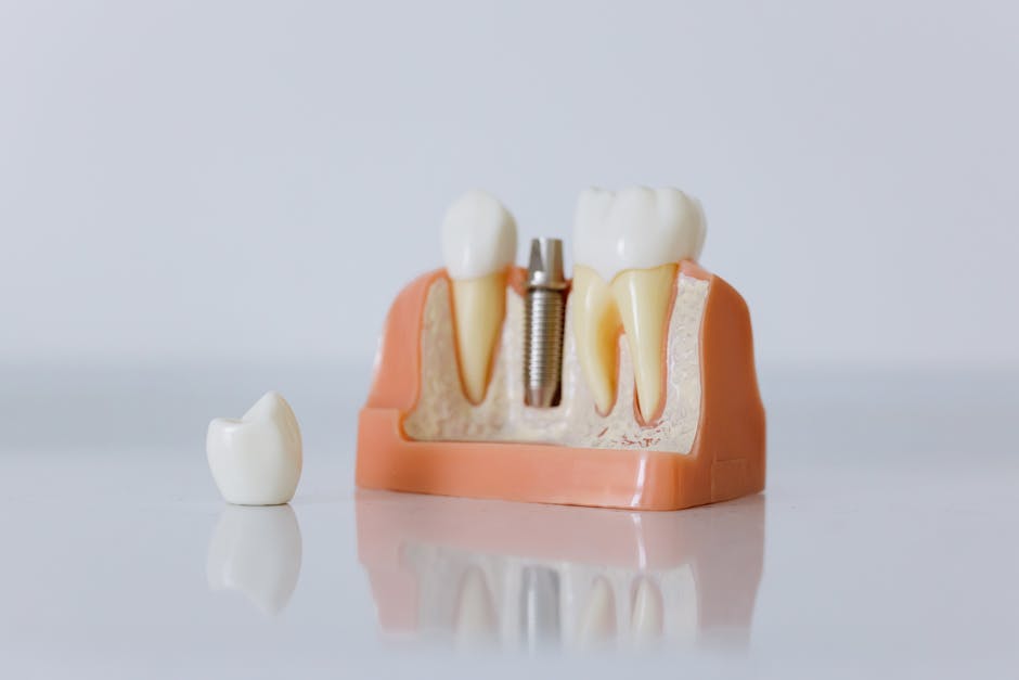 Primer plano del modelo de implante dental