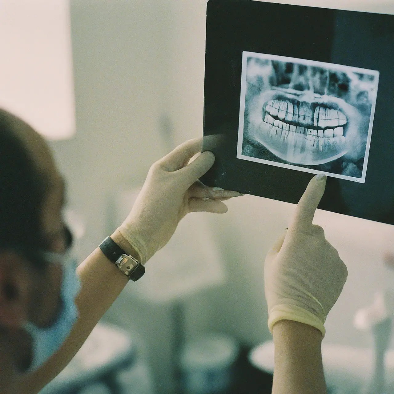 A dentist examining a dental X-ray. 35mm stock photo