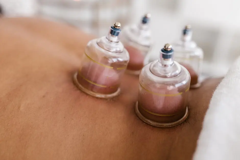 Detailed image of cupping therapy on a person’s back, showcasing alternative medicine practice.