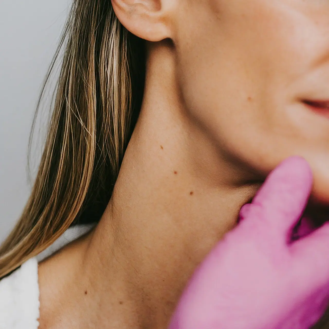Close-up of a dermatologist examining a patient’s skin carefully. 35mm stock photo